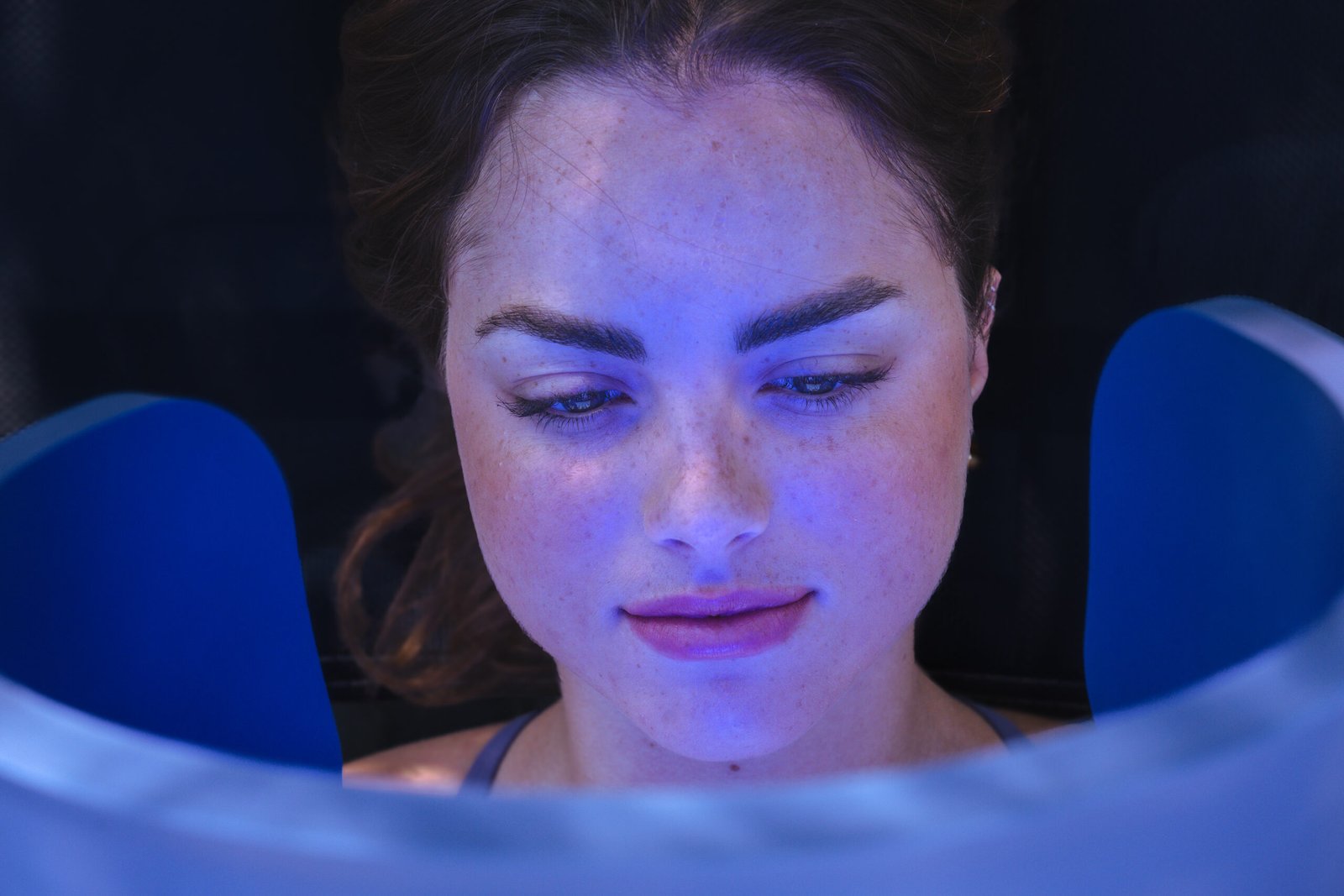 Лечение на акне